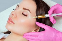 Mesoterapia facial