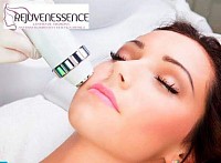 Radiofrecuencia facial